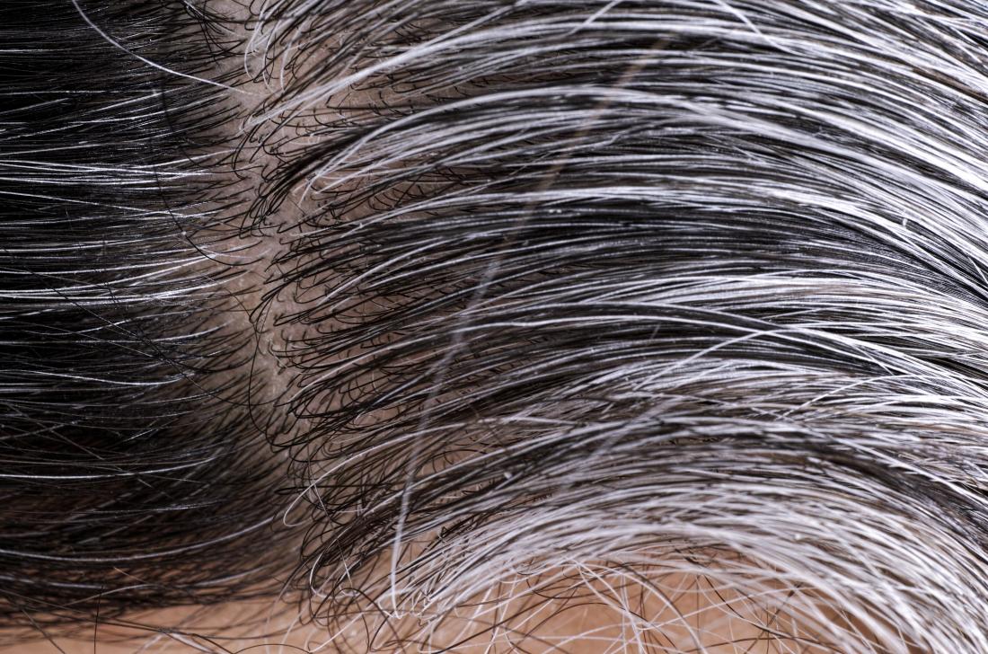Hair Care TIPS: Get rid of white hair, easy home tips to follow