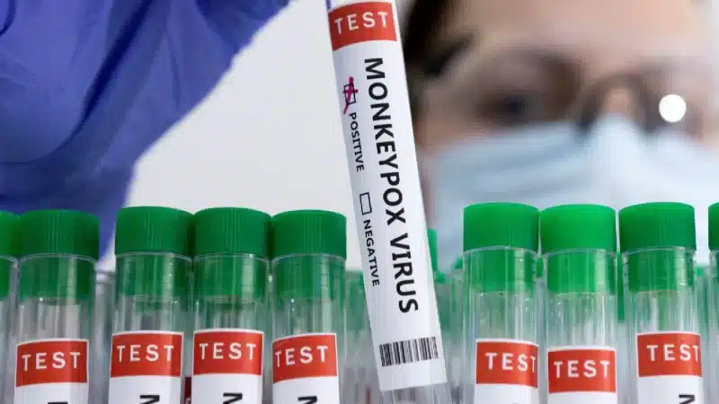 Chennai-based company made RT-PCR kit to detect monkeypox