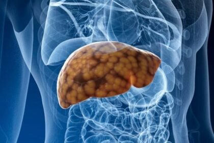 Liver 2