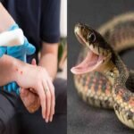 Jharkhand Be careful of snakebite, health department Arun Kumar Singh issued advisory regarding anti snake venom