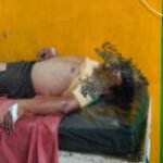 Koderma Hotel operator dies due to snake bite