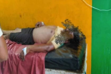 Koderma Hotel operator dies due to snake bite