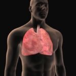 Lungs Cancer in India.The concern of the governments of all the countries including WHO has increased