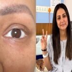 Actress Hina Khan, who is battling cancer, has only one eyelid left in her eyes, shared an emotional post