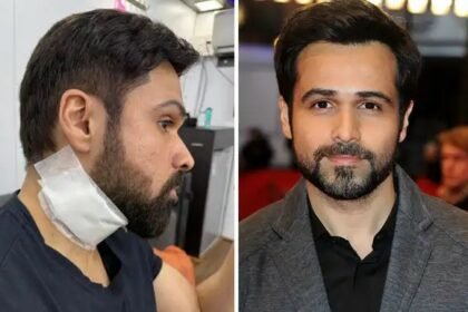 Emraan Hashmi injured during shooting, pictures went viral