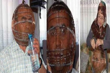 smoking quit unique case