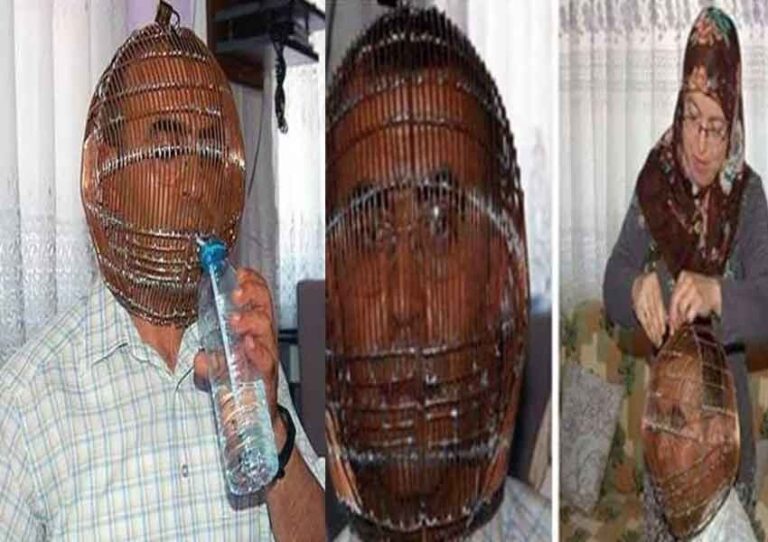 smoking quit unique case