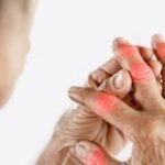 Calcium Deficiency