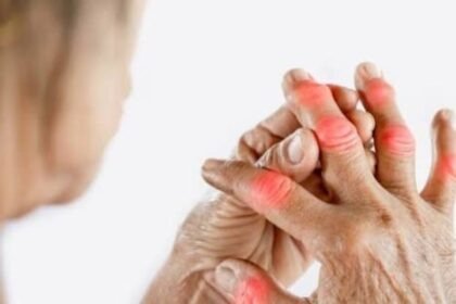 Calcium Deficiency