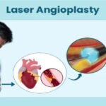 Noida hospital news, Excimer laser coronary angioplasty, heart