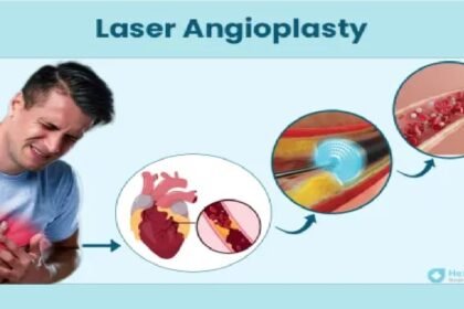 Noida hospital news, Excimer laser coronary angioplasty, heart
